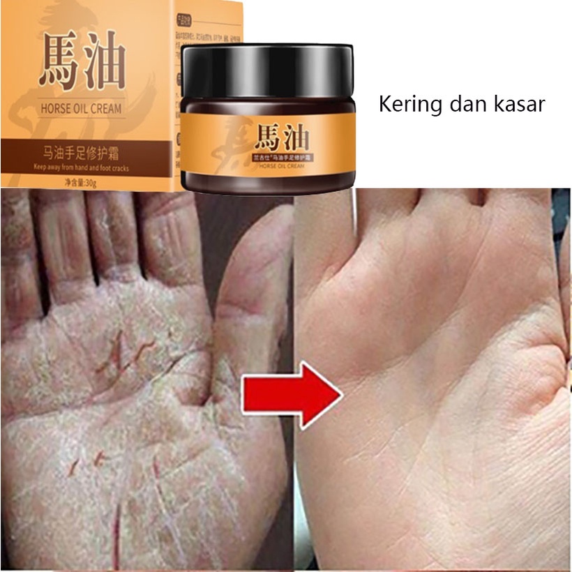 Krim Tangan dan Kaki obat kaki pecah dan kering pemutih tangan dan kaki 30g Pelembab tahan lama Memperbaiki kulit kering Memperbaiki tumit pecah-pecah