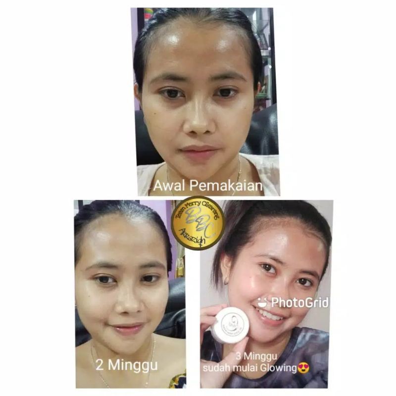 BEB WHITE C SKINCARE ORIGINAL 100% Glowing Series - Acne Series