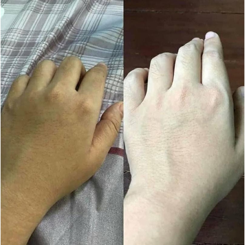 PEMUTIH BADAN PERMANEN BLEACHING BADAN NATURALE 1000GR ORIGINAL BLEACING BADAN PEMUTIH KULIT BLECING BADAN PEMUTIH BADAN AMPUH PEMUTIH BADAN PERMANEN BPOM CREAM PEMUTIH BADAN