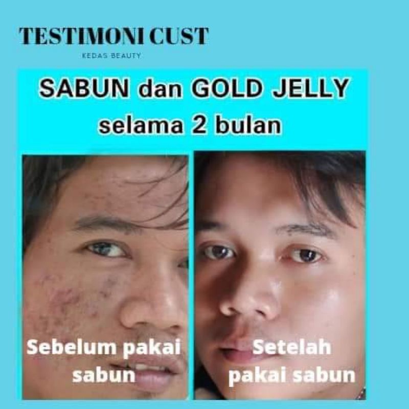 PAKET HEMAT GOLD JELLY + SABUN KEDAS BEAUTY 100% ORIGINAL By Kedas Beauty Palu