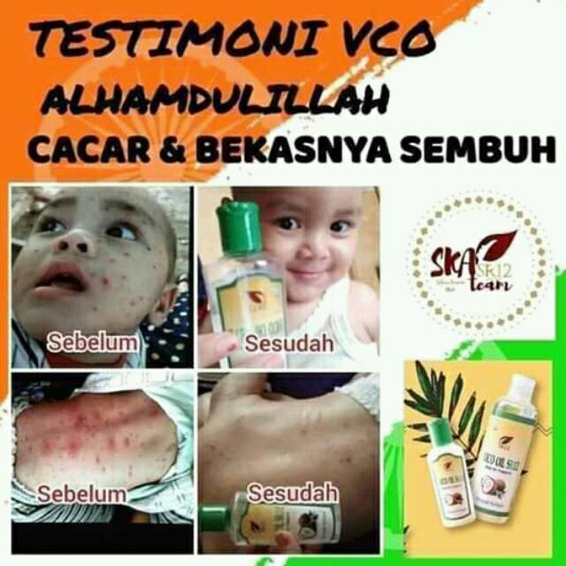 

Vico Oil sejuta manfaat