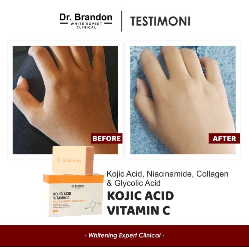 Dr brandon Soap Bar Kojic+Vitamin C Brightening Revitalizing Body&amp;face