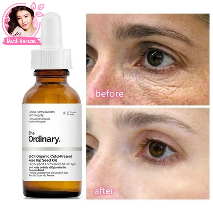 The Ordinary 100% Organic Cold-Pressed Rose Hip Seed Oil 30ml