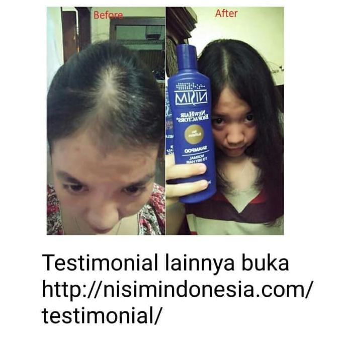 476G84Y7-Terlaris-Sale-- Nisim Penumbuh Rambut
