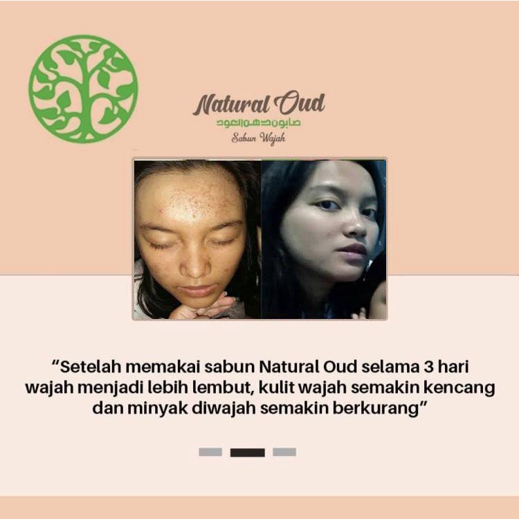 Natural Oud Sabun Cuci Muka Pemutih Wajah Glowing Pembersih Jerawat Kulit Wajah Jadi Cerah dan Sehat BPOM 100% Original Glowup Dari Sekarang