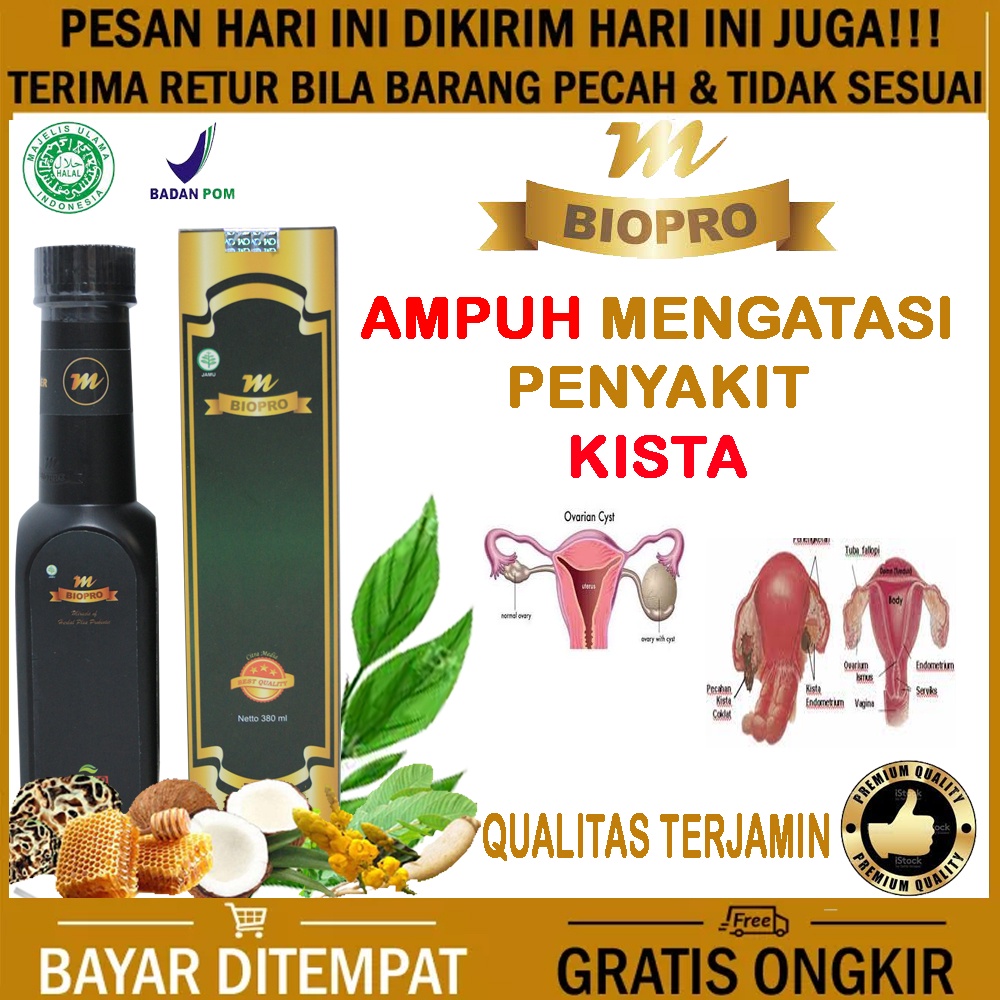 Jual Obat Kista Ovarium - Kista Bartholin, Endometriosis, Ganglion ...