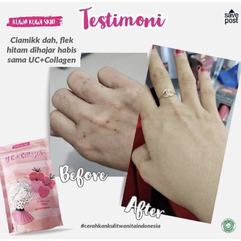 uc collagen[kuwakuwiskin]Bpom isi 125 gr{susu pemutih}