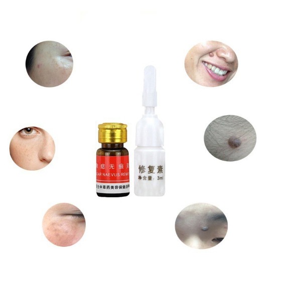 Penghilang Kutil Tahi Lalat Spot Skintag Remover