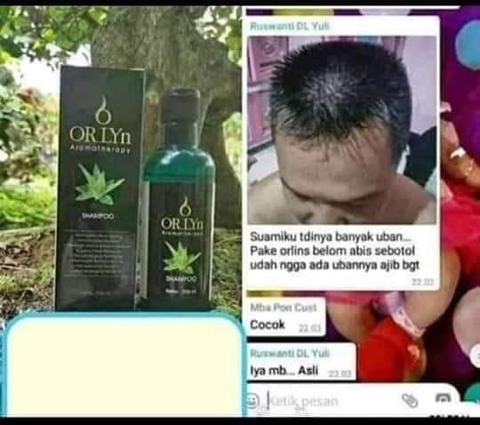 Shampo Pelembut Rambut Dan Penghilng Uban