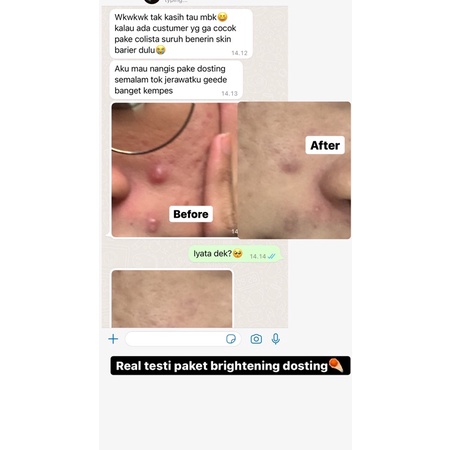 Paket Brightening dosting Colista skin care-2