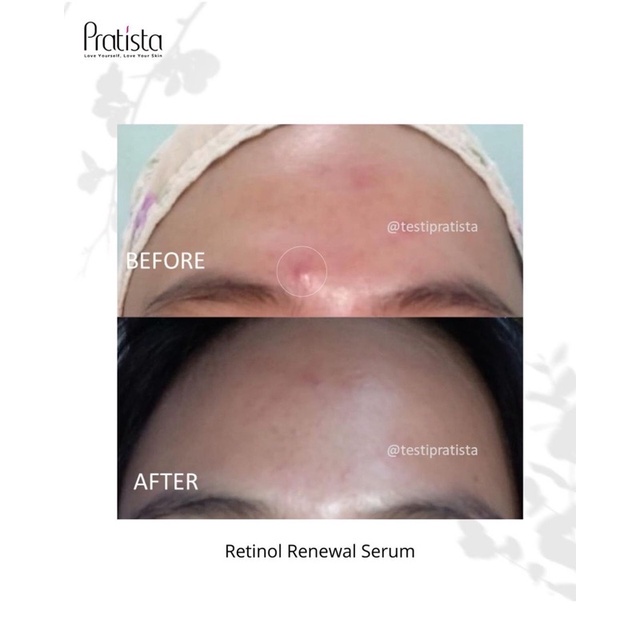 PRATISTA Retinol Renewal Serum BPOM 30ml / 10ml