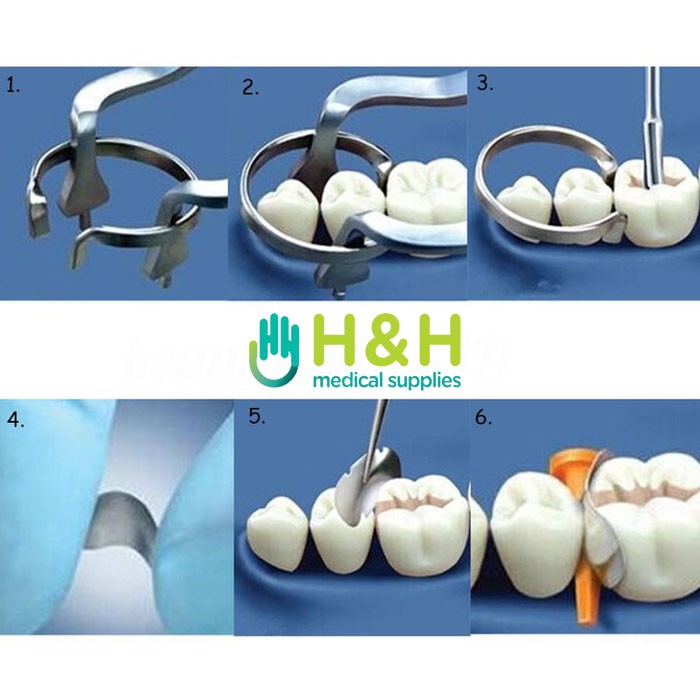 Sectional Matrix / Dental Contoured Sectional Matrix / Matrix Sectional Metal