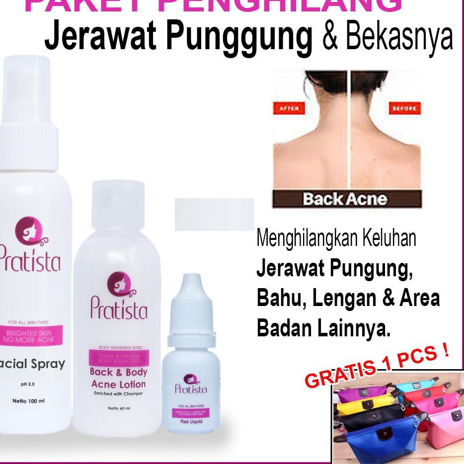 Jual Best Sellers Paket Obat Jerawat Di Punggung Dada Dan Badan Penghilang Jerawat Punggung Obat Je Indonesia Shopee Indonesia