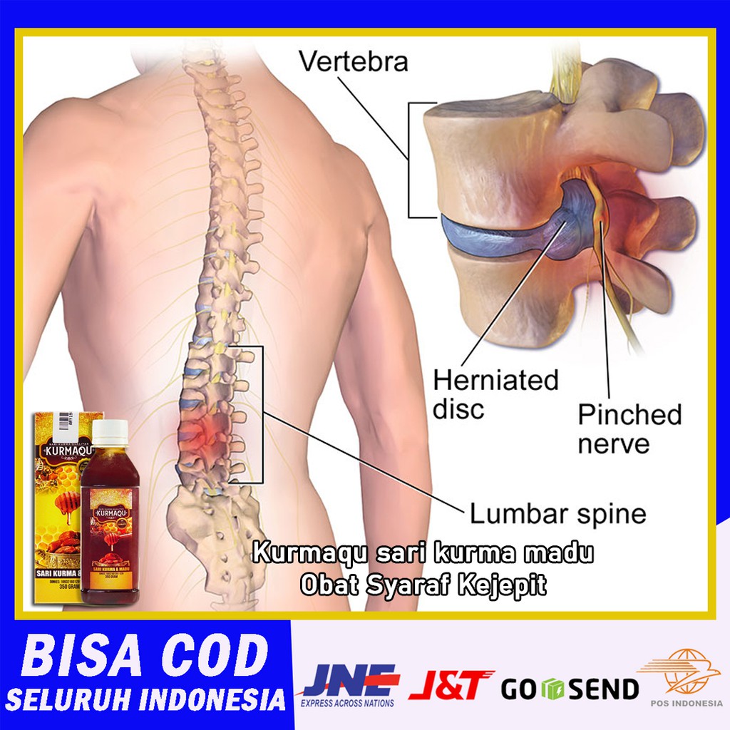 Obat Syaraf Kejepit, Nyeri Sendi dan Otot - KurmaQu Sari Kurma & Madu