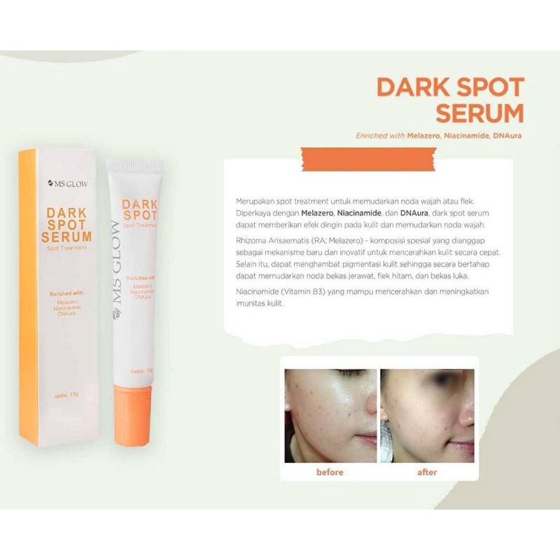 Dark spot ms glow / serum flek / ms glow darkspot serum