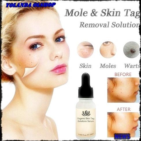 20ml Organic Mighty Skin Tag Spots Remover Solution Serum (NEWS)