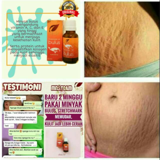 Minyak Bulus Sr12 Penghilang Stretch Mark Penghilang Selulit 100 Original Wangi Tidak Bau Amis Shopee Indonesia