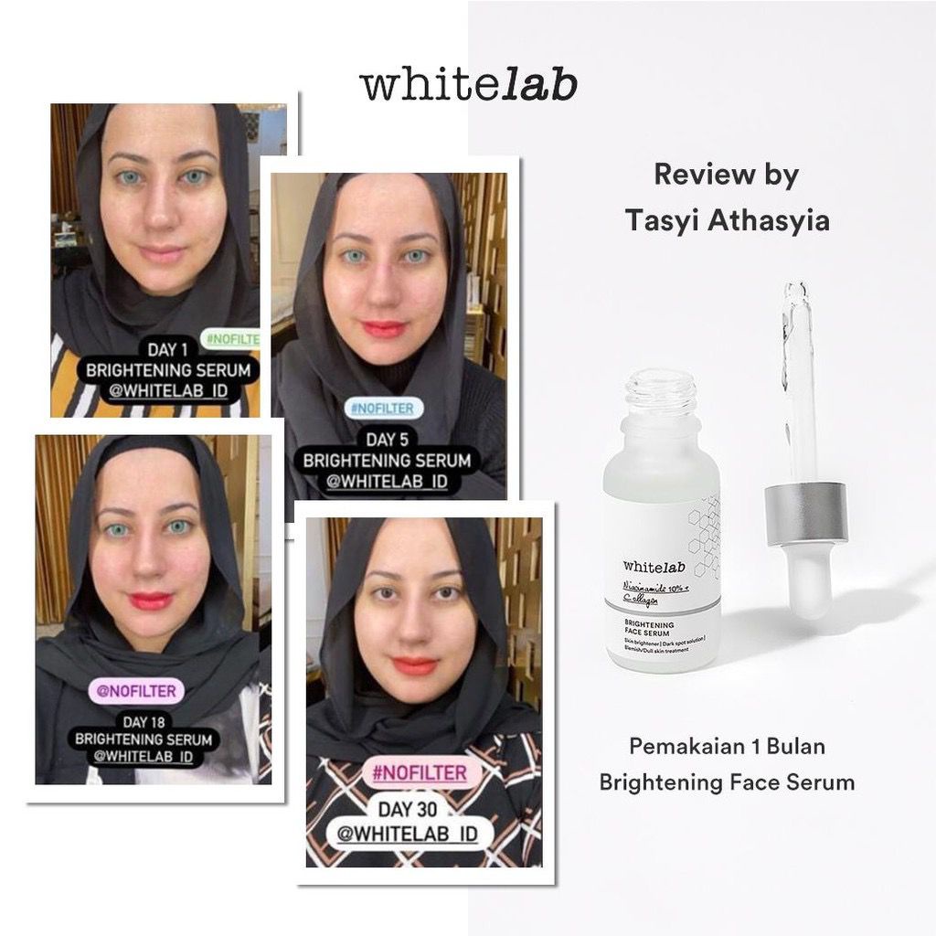 Whitelab Brightening Face Serum - Nicianamide 10%