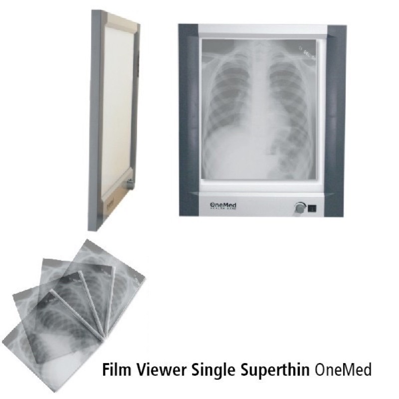 Lampu Xray Viewer Single Slide ONEMED Film Viewer Single Supertin F1 LED Lampu Ronsen Rontgen