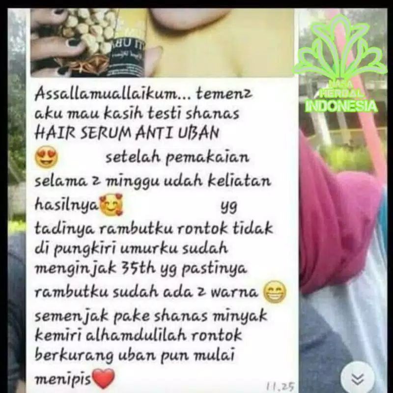 COD FREE ONGKIR Terlaris Serum Penghilang Uban Shampo Anti uban shanas ampuh