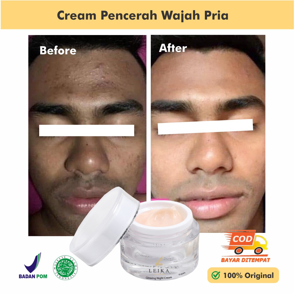 Hasil Maksimal Pencerah Wajah Wajah Pria Pemutih Wajah Pria Cepat Bpom Pencerah Wajah Kusam Bpom Pen