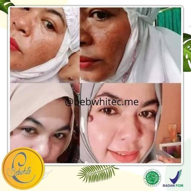 (BISA COD) BebwhiteC Glow Series/Acne Series