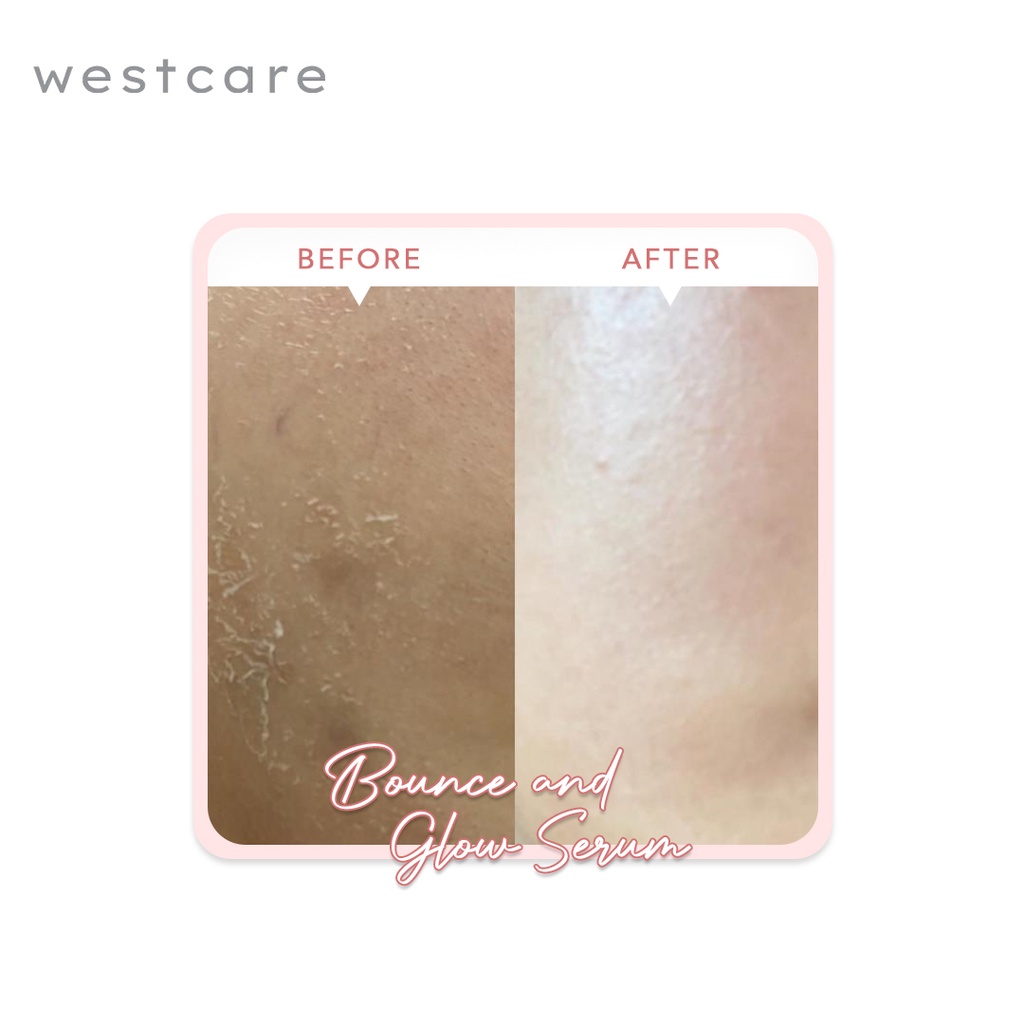 Westcare Bounce and Glow Serum-6