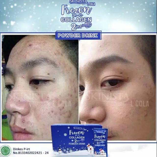 READY [BPOM] Frozen Collagen Powder Drink By Skinista / Frozen Collagen Original