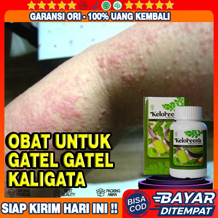 Jual Obat Gatel Kaligata Obat Biduran Alami Obat Gatal Gatal Di