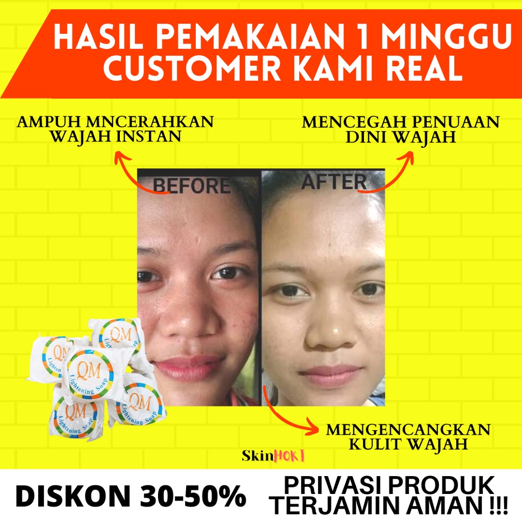 SABUN PEMUTIH WAJAH GLOWING PENGHILANG FLEK HITAM SABUN QM BRIGHTENING SOAP ORIGINAL BPOM