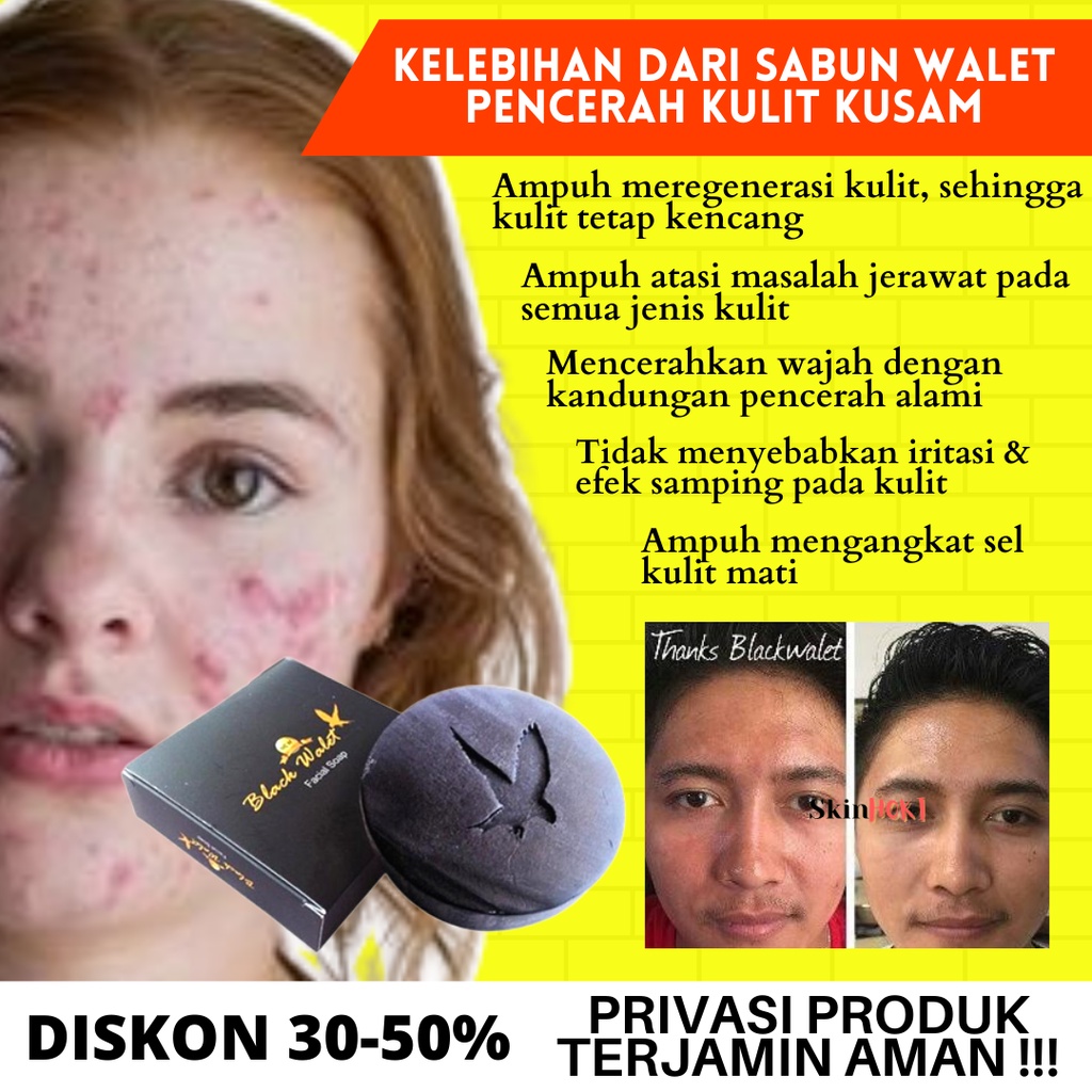 SABUN BATANG PEMUTIH WAJAH PENGHILANG BEKAS JERAWAT SABUN BLACK WALET ORIGINAL BPOM