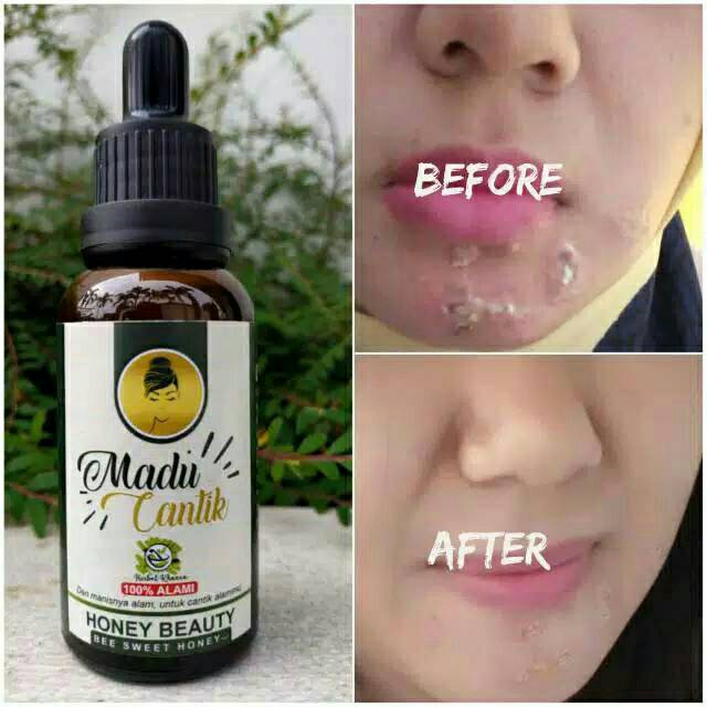 

MADU CANTIK SYAKEEL.SHOPE