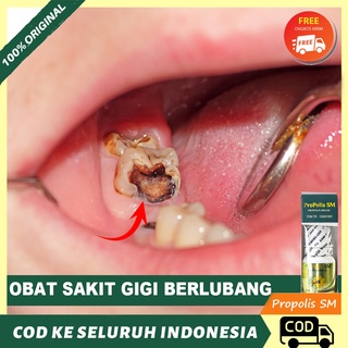 Obat Sakit Gigi Berlubang