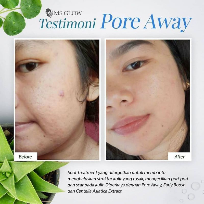 PROMO SPOT TREATMENT MSGLOW DARK SPOT PORE AWAY ACNE SPOT