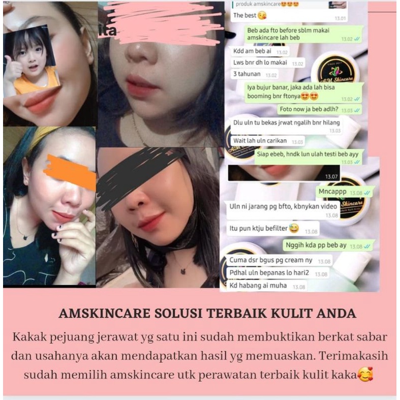 PAKET KULIT NORMAL BY AMSKINCARE | PUTIH GLOWING