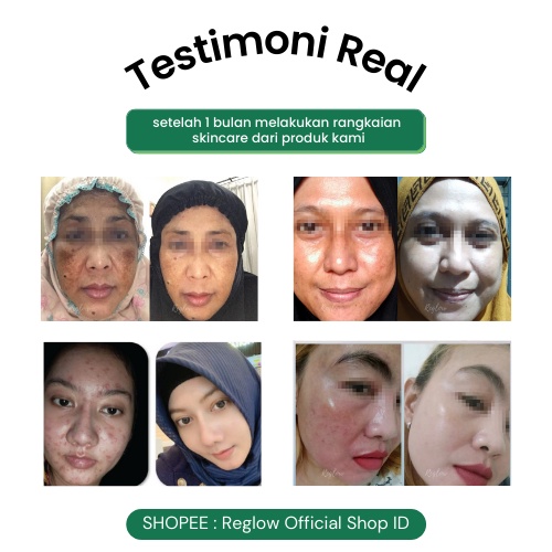 Reglow Skincare Original Official Perawatan Wajah Berjerawat Re Glow Penghilang Flek Hitam Bruntusan Komedo Milia Pori Besar Pencerah Wajah Kusam Berminyak Reg Glow Beauty Skin Care dr Shindy Putri