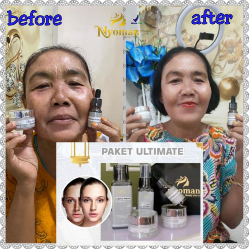 paket flek nyoman (free tas kosmetik)