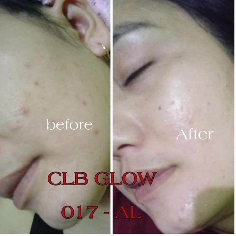 TER clb glow skincare / clbglow skincare / gb glow ASLI 100% ber ID card RESMI M15K