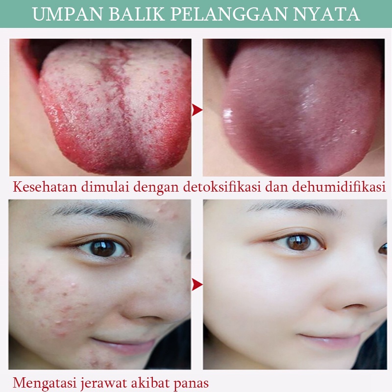 Detoks Herbal Kaki Perawatan kaki Pelangsing alami 50 pcs Ekstrak herbal alami Mengeluarkan racun dari dalam tubuh Detoksifikasi dan dehumidifikasi Perawatan lembut Tidur nyenyak sepanjang malam