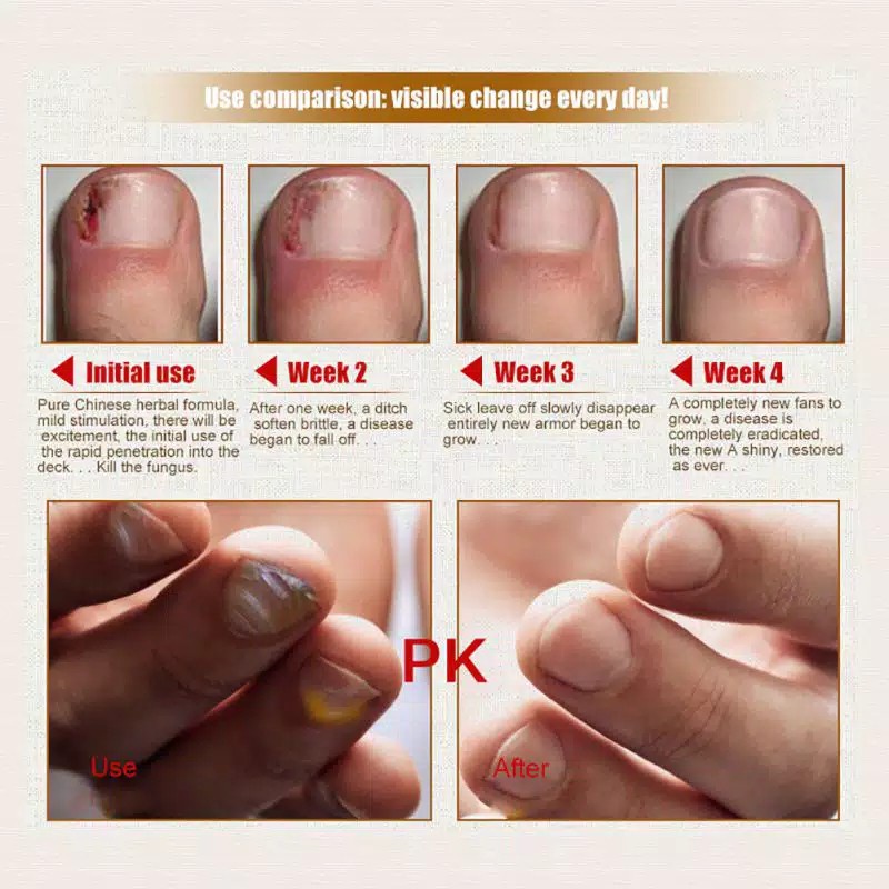 WATER ICE LEVIN Serum Kuku Nature Nail Repair Treatment Essential Oil