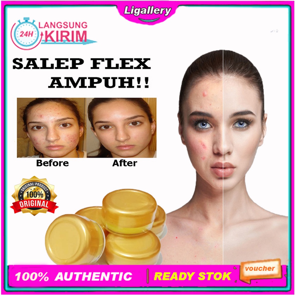 [BISA COD+Asli] Salep Flek Hitam Melasma Ampuh Salep Wajah Menghilangkan Flex Hitam Dan Jerawat