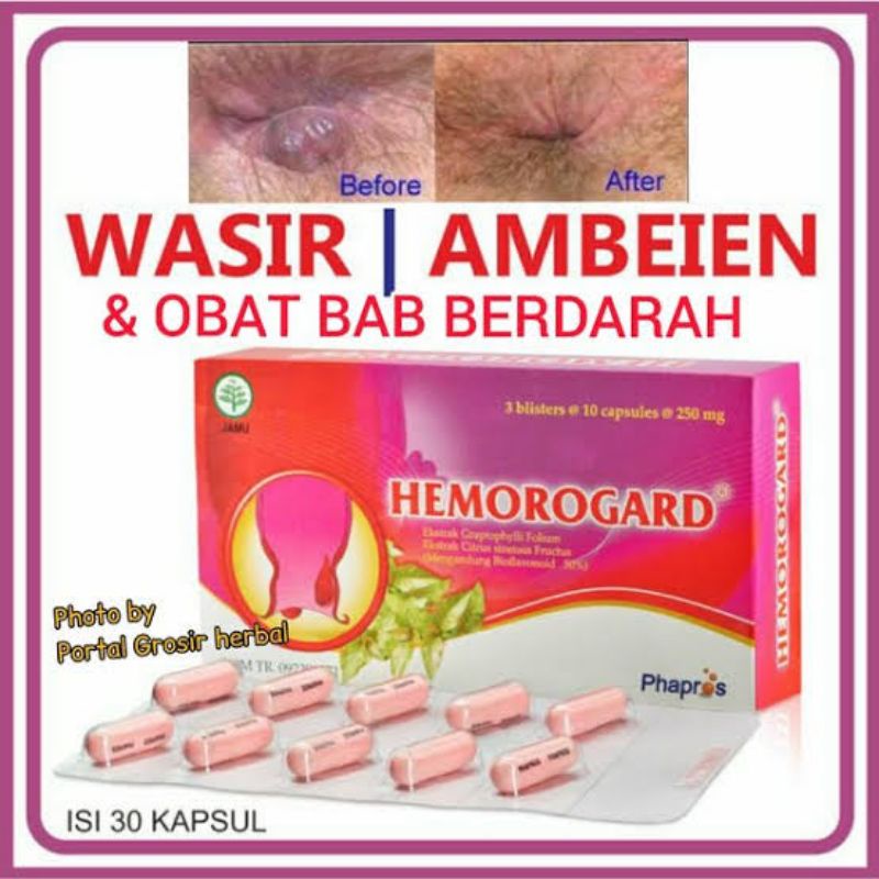 ORIGINAL HEMOROGARD 30 KAPSUL 1 BOX / OBAT WASIR AMBEIEN HEMOROGARD 1 BOX ISI 30 KAPSUL