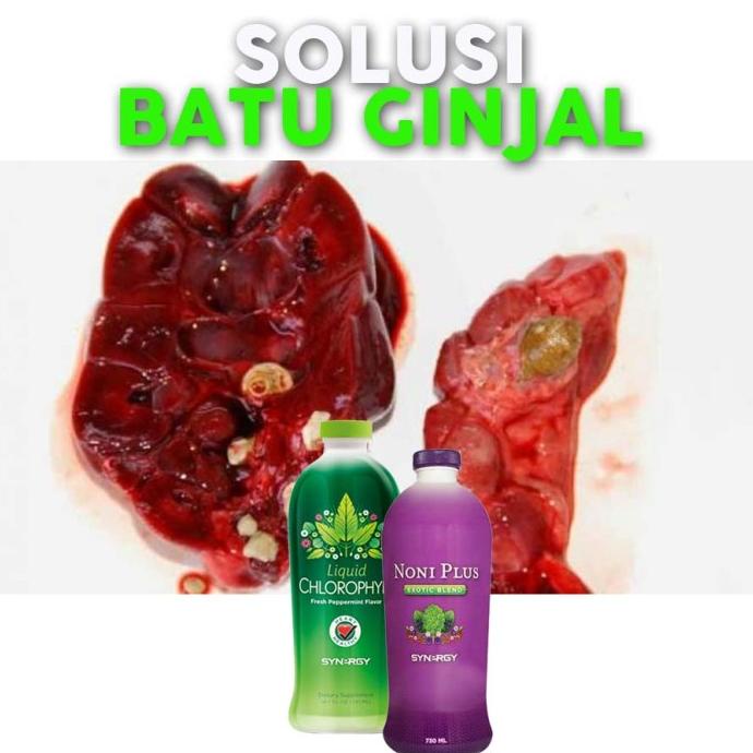 ORIGINAL HERBAL Obat Alami Penghancur Batu Ginjal Klorofil NoniPlus Synergy Asli