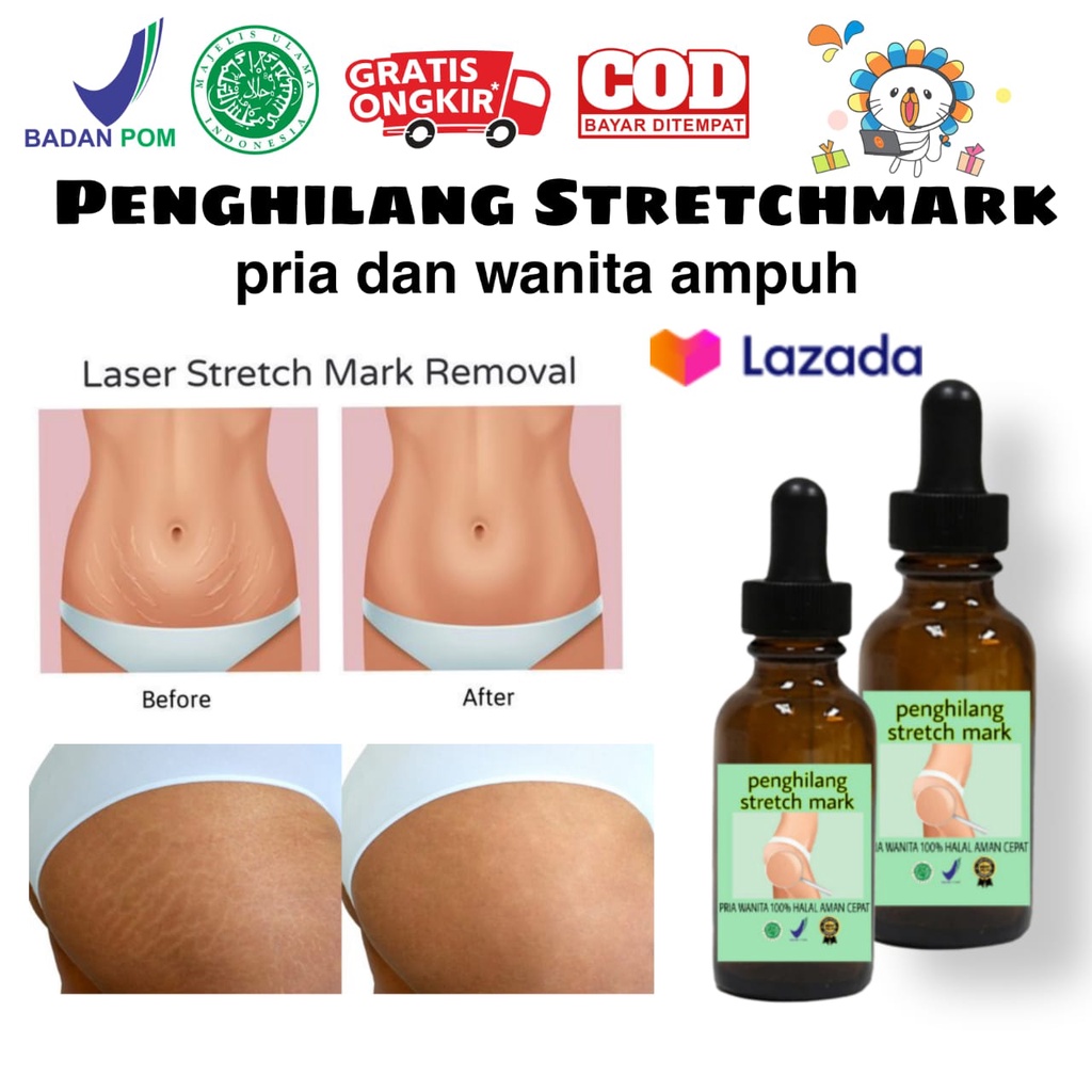 serum penghilang strechmark/penghilang strechmark/penghilang strechmark ampuh bpom/penghilang strech