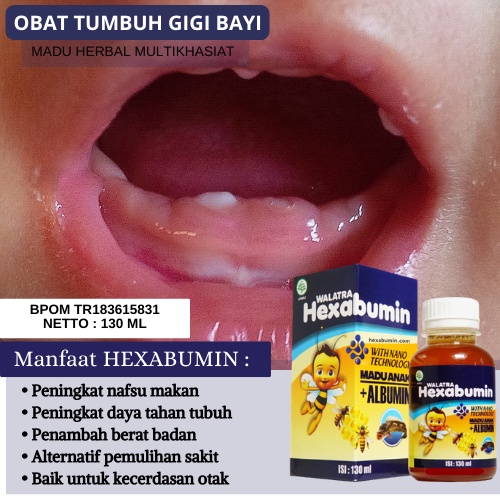 Obat Tumbuh Gigi Bayi, Penumbuh Gigi Anak, Obat Penumbuh Gigi Anak, Penumbuh Gigi Ompong, Perapih Gi