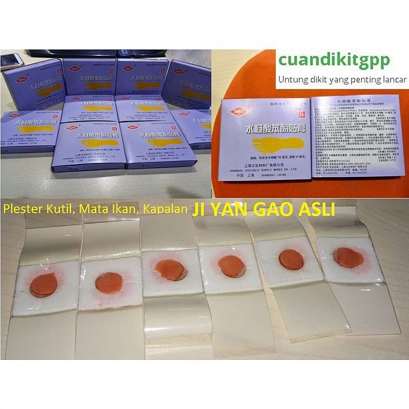 Plester Obat Kutil & Mata Ikan Penutup Kutil Koyo Kutil ji yan gao Menghilangkan di Seluruh Area Sam-2
