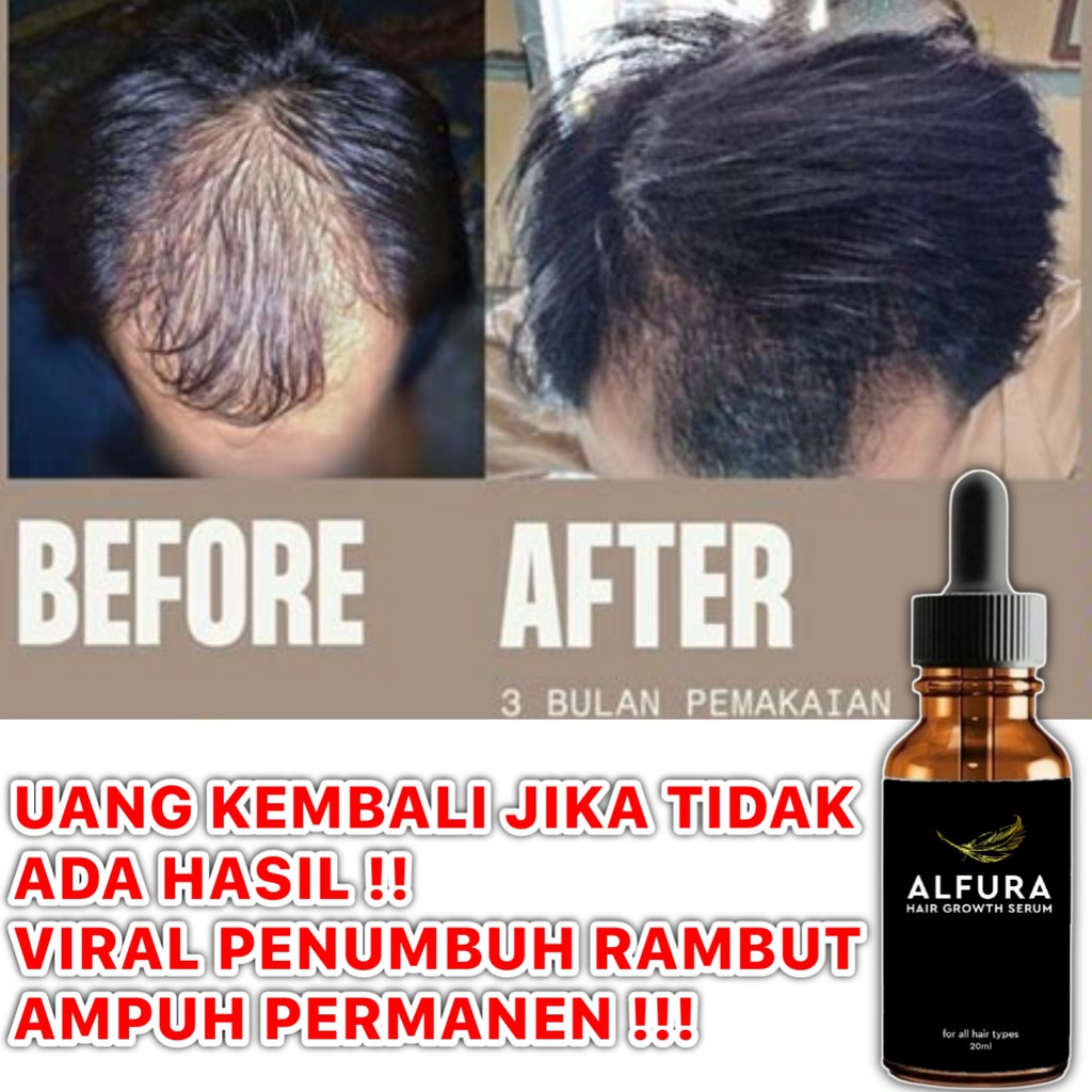 

alfura