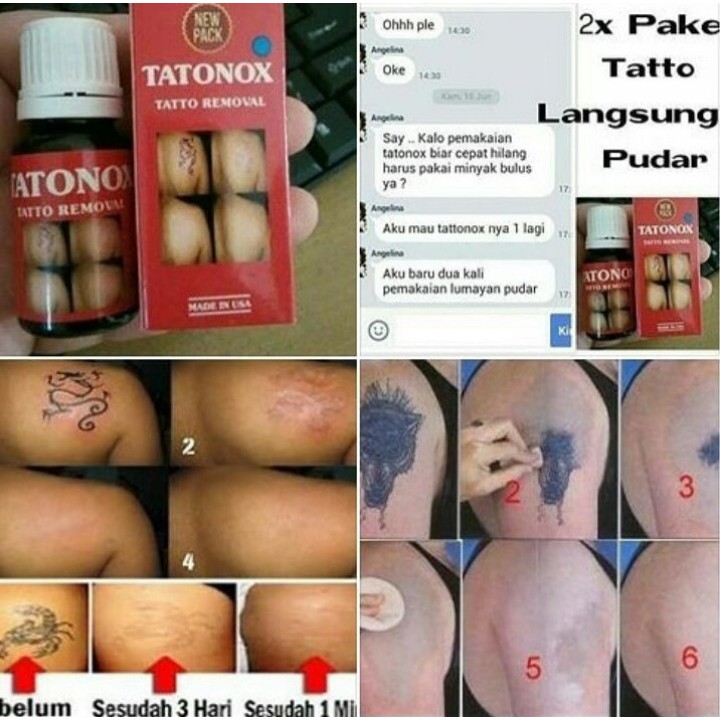 Penghapus Penghilang Tato Permanen Tatonox ab