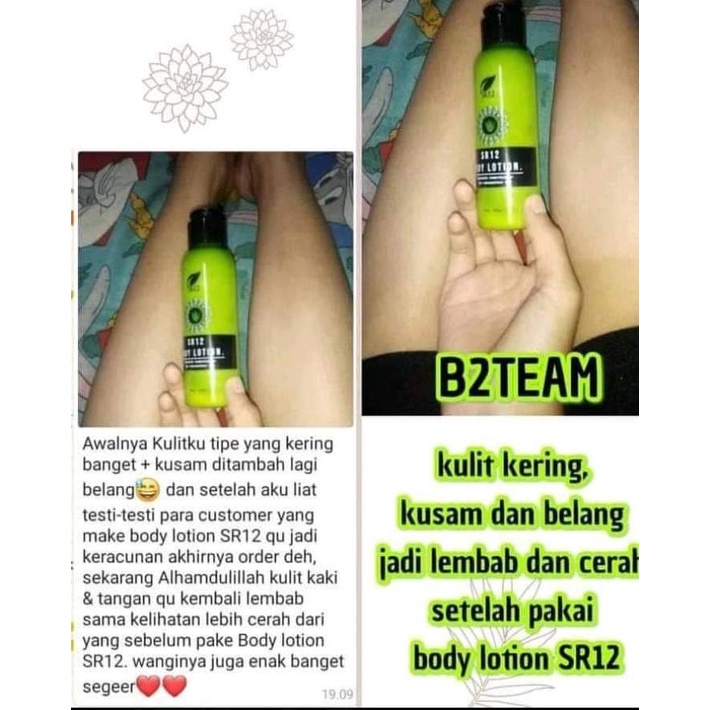 Paket Anti Belang Suncare Body Lotion SR12 Mencerahkan Melembabkan dan Menjaga Kulit dari Sinar UV