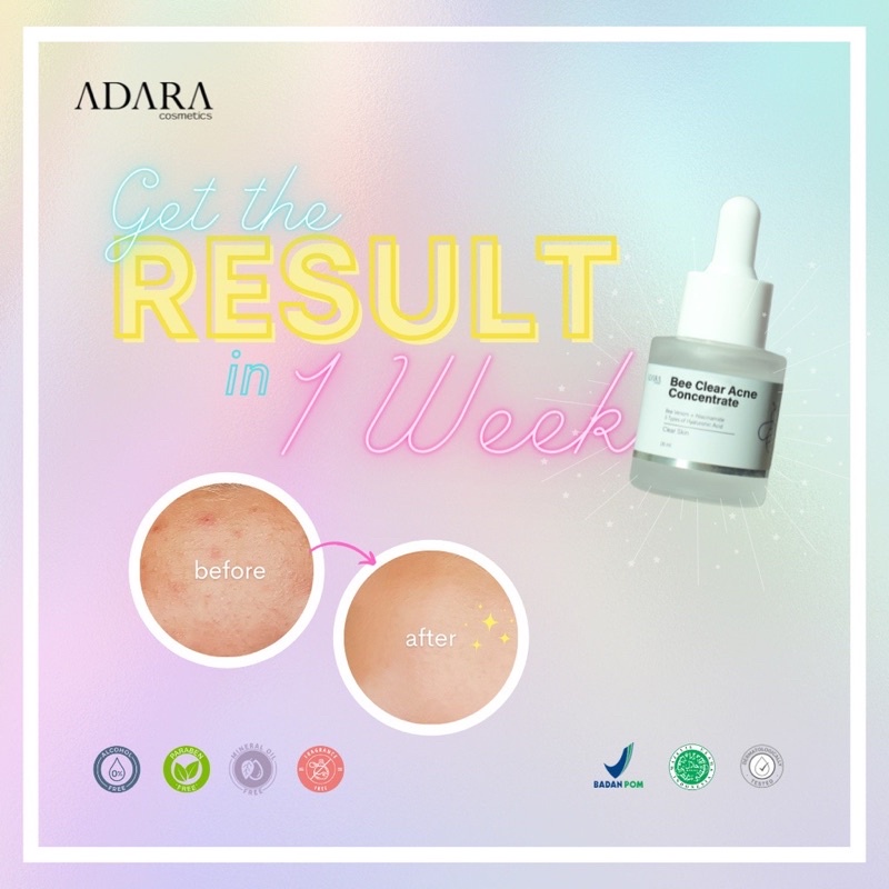 ADARA Bee Clear Acne Concentrate Serum 20ml (Bee Venom + TR Salicylic Acid + 3HA Serum)